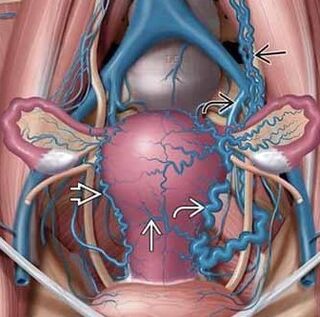 Cambiare la struttura delle pareti vascolari