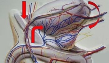 Vene varicose delle vene pelviche