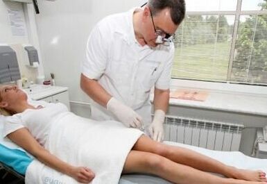 Diagnosi di vene varicose